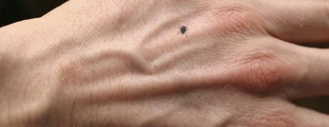 caz confirmat de encefalită de căpuşe la un cioban de 33 de ani din moşna