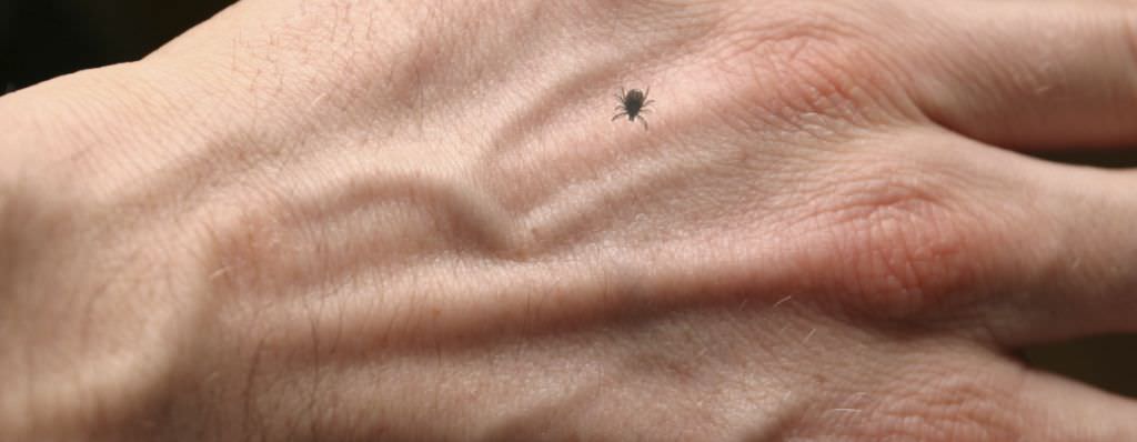 aproape 50 de sibieni înțepați de căpușe în ultimele 2 zile. unul este internat