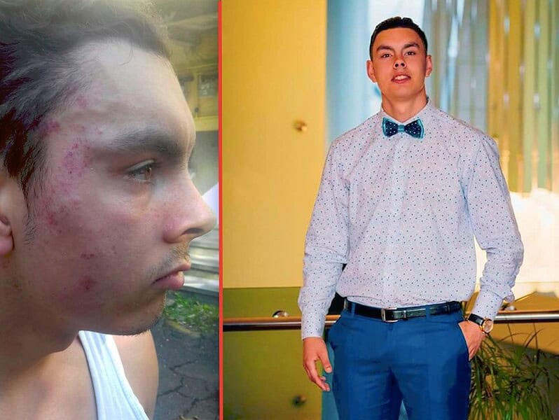 foto – tânăr bătut de un taximetrist la sibiu. spune că a fost agresat fără motiv